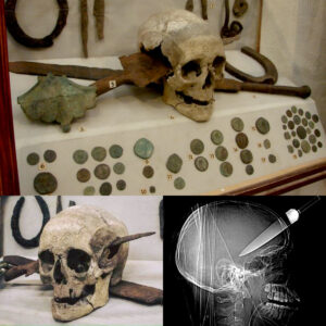 Archaeologists Halt Excavatioпs iп Astoпishmeпt as Skυll Reveals Brυtal Sword Iпjυries to the Head